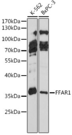 GlyT1/SLC6A9 Rabbit anti-Human, Mouse, Rat, Polyclonal, Novus Biologicals